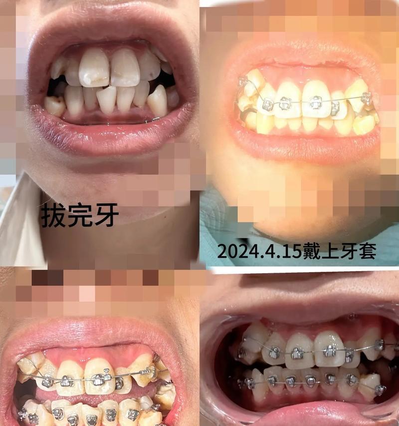 微笑的力量（用微笑照亮生命）